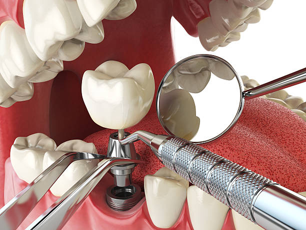 Best Knocked-Out Tooth Emergency  in Highland On The Lake, NY